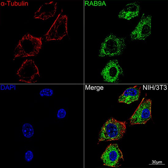 Immunocytochemistry/ Immunofluorescence: RAB9A Antibody (7O1G4) [NBP3-16506] - Confocal imaging of NIH/3T3 cells using RAB9A Rabbit mAb (Green). The cells were counterstained with Alpha-tubulin (ubiquitous) chain Rabbit mAb . DAPI was used for nuclear staining (blue). Objective: 60x.