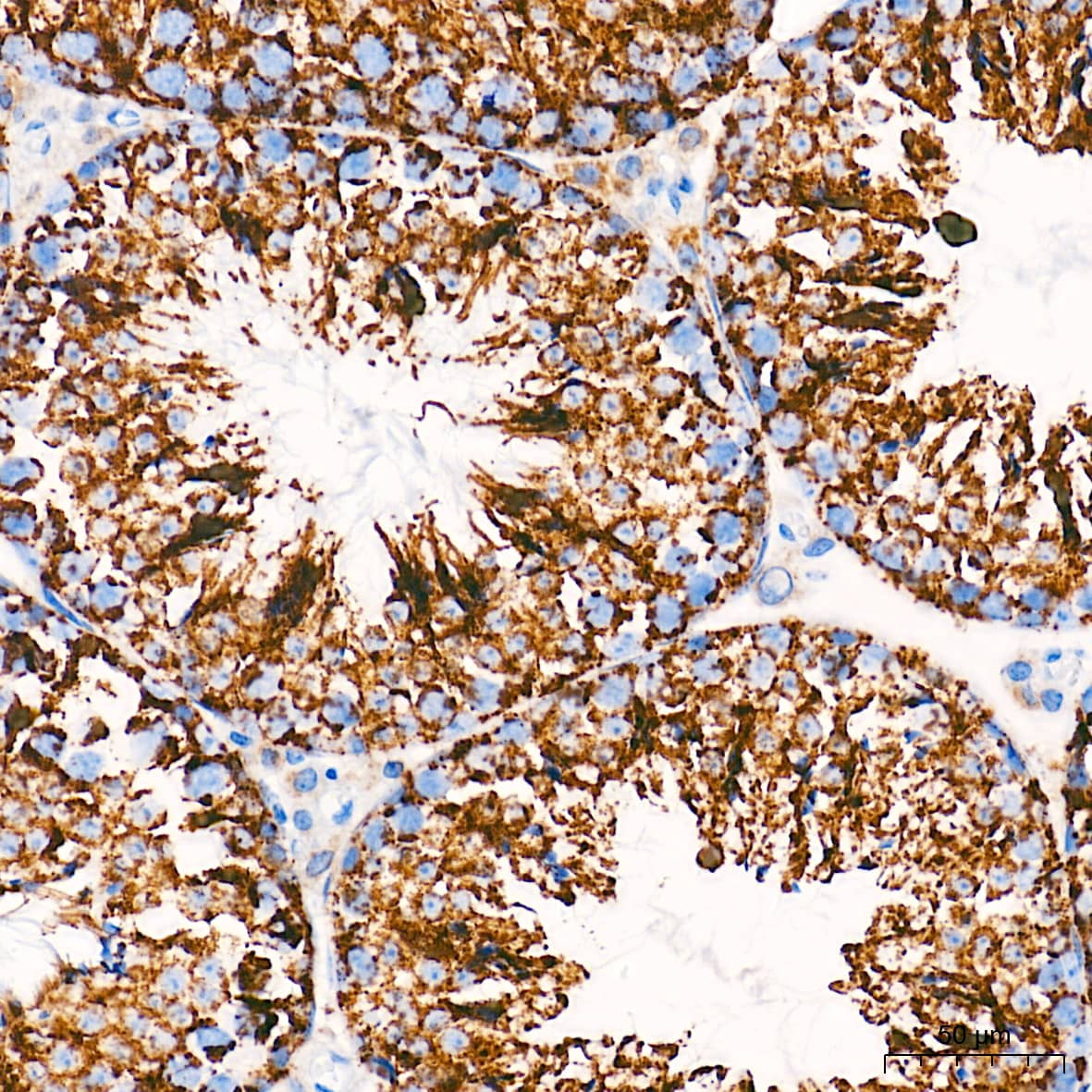 Immunohistochemistry: Cytochrome c Antibody (6R10F3) [NBP3-16512] - Immunohistochemistry analysis of paraffin-embedded Mouse testis tissue using Cytochrome c Rabbit mAb at a dilution of 1:500 (40x lens). High pressure antigen retrieval performed with 0.01M Tris-EDTA Buffer (pH 9.0) prior to IHC staining.