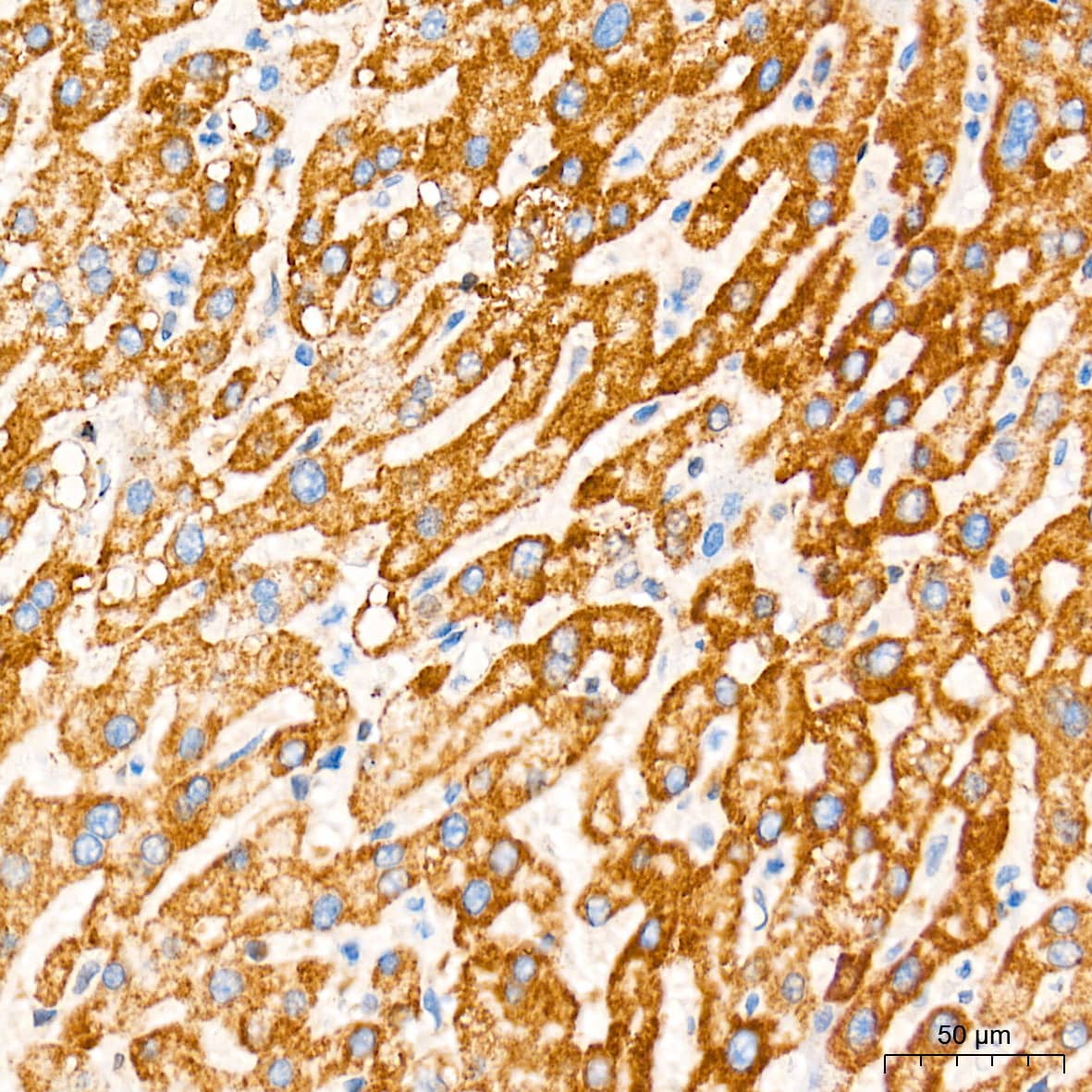 Immunohistochemistry: Cytochrome c Antibody (6R10F3) [NBP3-16512] - Immunohistochemistry analysis of paraffin-embedded Human liver tissue using Cytochrome c Rabbit mAb at a dilution of 1:500 (40x lens). High pressure antigen retrieval performed with 0.01M Tris-EDTA Buffer (pH 9.0) prior to IHC staining.