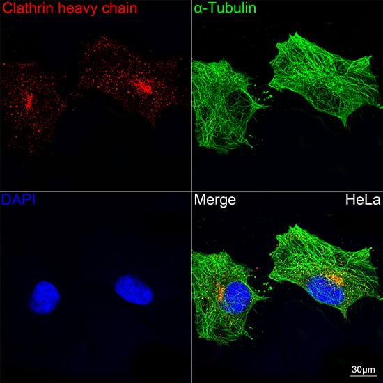 Immunocytochemistry/ Immunofluorescence: Clathrin Heavy Chain 1/CHC17 Antibody (9M2G2) [NBP3-16518] - Confocal imaging of HeLa cells using Clathrin Heavy Chain 1/CHC17 Rabbit mAb . The cells were counterstained with alpha-Tubulin Rabbit mAb (Green). DAPI was used for nuclear staining (blue). Objective: 60x.