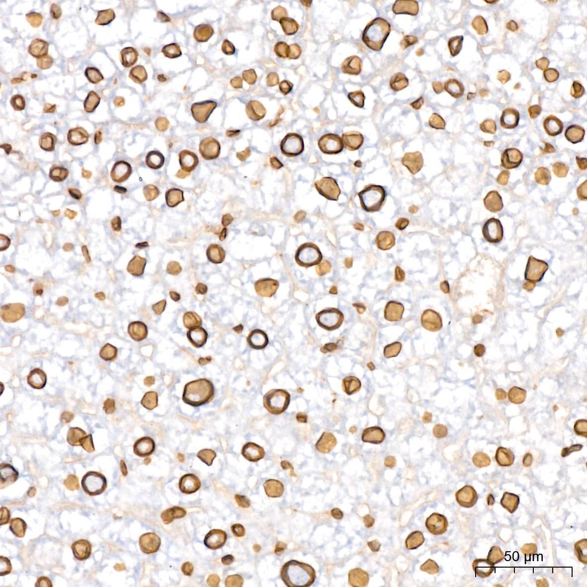 Immunohistochemistry: Lamin B2 Antibody (1S9M6) [NBP3-16527] - Immunohistochemistry analysis of paraffin-embedded Mouse liver tissue using Lamin B2 Rabbit mAb at a dilution of 1:200 (40x lens). High pressure antigen retrieval was performed with 0.01 M citrate buffer (pH 6.0) prior to IHC staining.