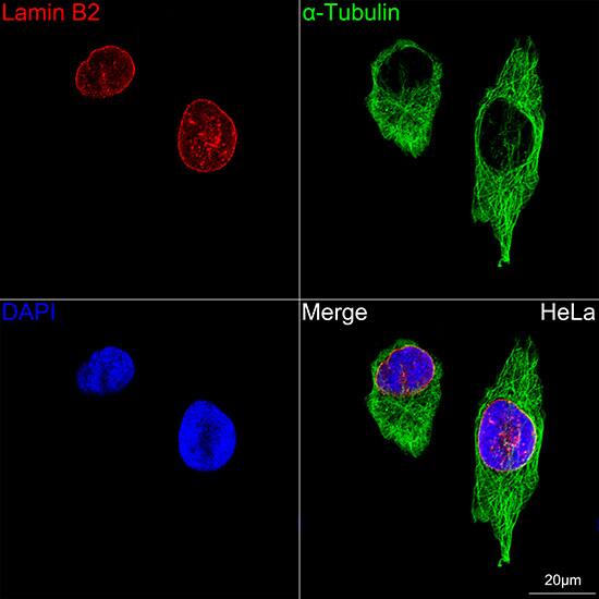 Immunocytochemistry/ Immunofluorescence: Lamin B2 Antibody (1S9M6) [Lamin B2] - Confocal imaging of HeLa cells using Lamin B2  Rabbit mAb  . The cells were counterstained with alpha-Tubulin Rabbit mAb  (Green). DAPI was used for nuclear staining (blue). Objective: 60x.