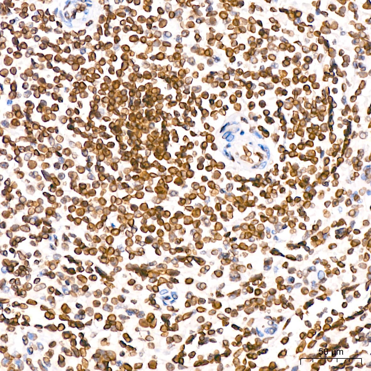 Immunohistochemistry: Lamin B2 Antibody (1S9M6) [Lamin B2] - Immunohistochemistry analysis of paraffin-embedded Human spleen tissue using Lamin B2 Rabbit mAb  at a dilution of 1:200 (40x lens). High pressure antigen retrieval was performed with 0.01 M citrate buffer (pH 6.0) prior to IHC staining.