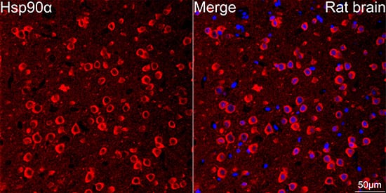 Immunocytochemistry/ Immunofluorescence: HSP90 alpha Antibody (0R3S6) [NBP3-16528] - Confocal imaging of paraffin-embedded Rat brain tissue using HSP90 alpha Rabbit mAb followed by a further incubation with Cy3 Goat Anti-Rabbit IgG (H+L) . DAPI was used for nuclear staining (Blue). Microwave antigen retrieval performed with 0.01M Citrate Buffer (pH 6.0) prior to IF staining. Objective: 40x.