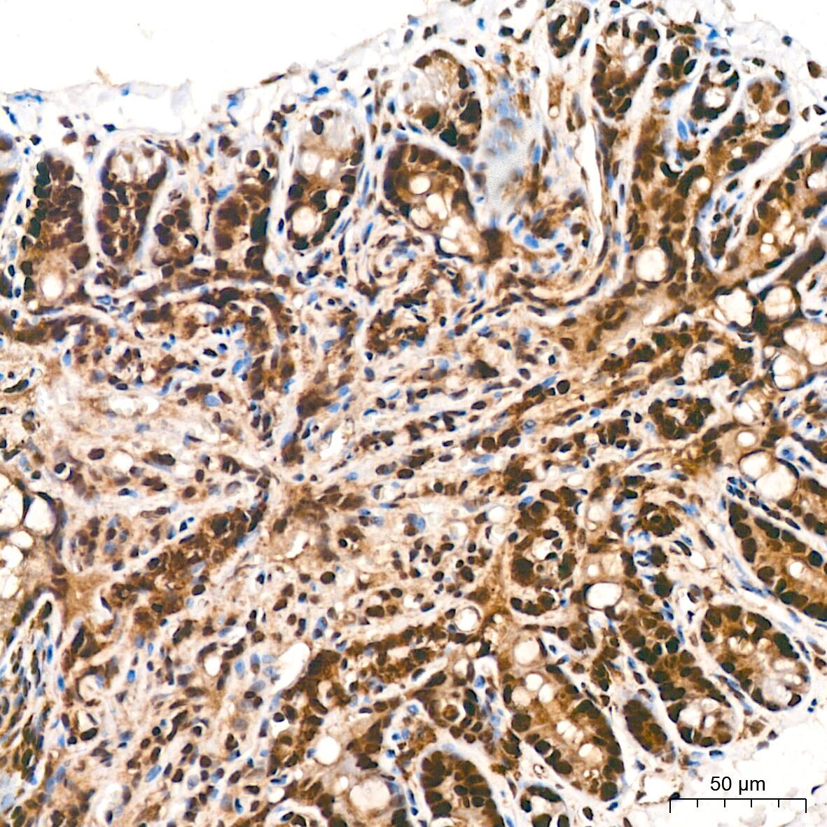 Immunohistochemistry: DDB1 Antibody (9L8X5) [NBP3-16531] - Immunohistochemistry analysis of paraffin-embedded Mouse colon tissue using DDB1 Rabbit mAb at a dilution of 1:800 (40x lens). High pressure antigen retrieval performed with 0.01M Tris-EDTA Buffer (pH 9.0) prior to IHC staining.