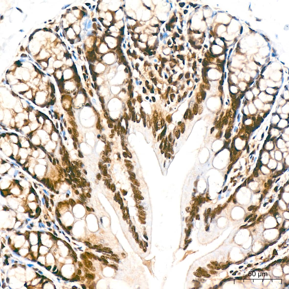 Immunohistochemistry: DDB1 Antibody (9L8X5) [NBP3-16531] - Immunohistochemistry analysis of paraffin-embedded Rat colon tissue using DDB1 Rabbit mAb at a dilution of 1:800 (40x lens). High pressure antigen retrieval performed with 0.01M Tris-EDTA Buffer (pH 9.0) prior to IHC staining.