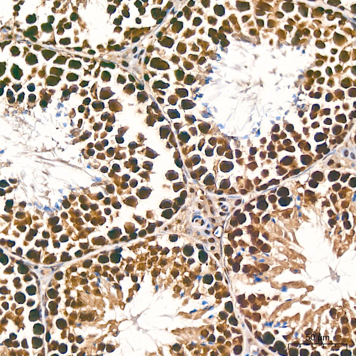 Immunohistochemistry: DDB1 Antibody (9L8X5) [NBP3-16531] - Immunohistochemistry analysis of paraffin-embedded Mouse testis tissue using DDB1 Rabbit mAb at a dilution of 1:800 (40x lens). High pressure antigen retrieval performed with 0.01M Tris-EDTA Buffer (pH 9.0) prior to IHC staining.