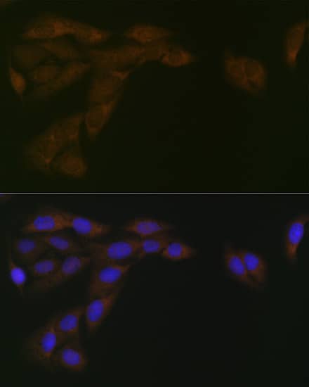 Immunocytochemistry/ Immunofluorescence: POR/Cytochrome P450 Reductase Antibody (9U1U7) [NBP3-16534] - Immunofluorescence analysis of U-2 OS cells using POR/Cytochrome P450 Reductase Rabbit mAb  at dilution of 1:100 (40x lens). Secondary antibody: Cy3 Goat Anti-Rabbit IgG (H+L)  at 1:500 dilution. Blue: DAPI for nuclear staining.