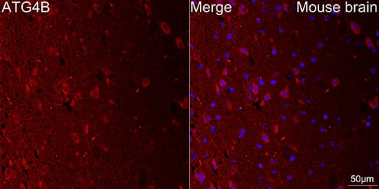 Immunocytochemistry/ Immunofluorescence: ATG4B Antibody (9H6M6) [NBP3-16538] - Confocal imaging of paraffin-embedded Mouse brain using ATG4B Rabbit mAb  followed by a further incubation with Cy3 Goat Anti-Rabbit IgG (H+L)  . Objective: 40x. DAPI was used for nuclear staining (Blue). Perform microwave antigen retrieval with 0.01 M citrate buffer (pH 6.0) prior to IF staining.