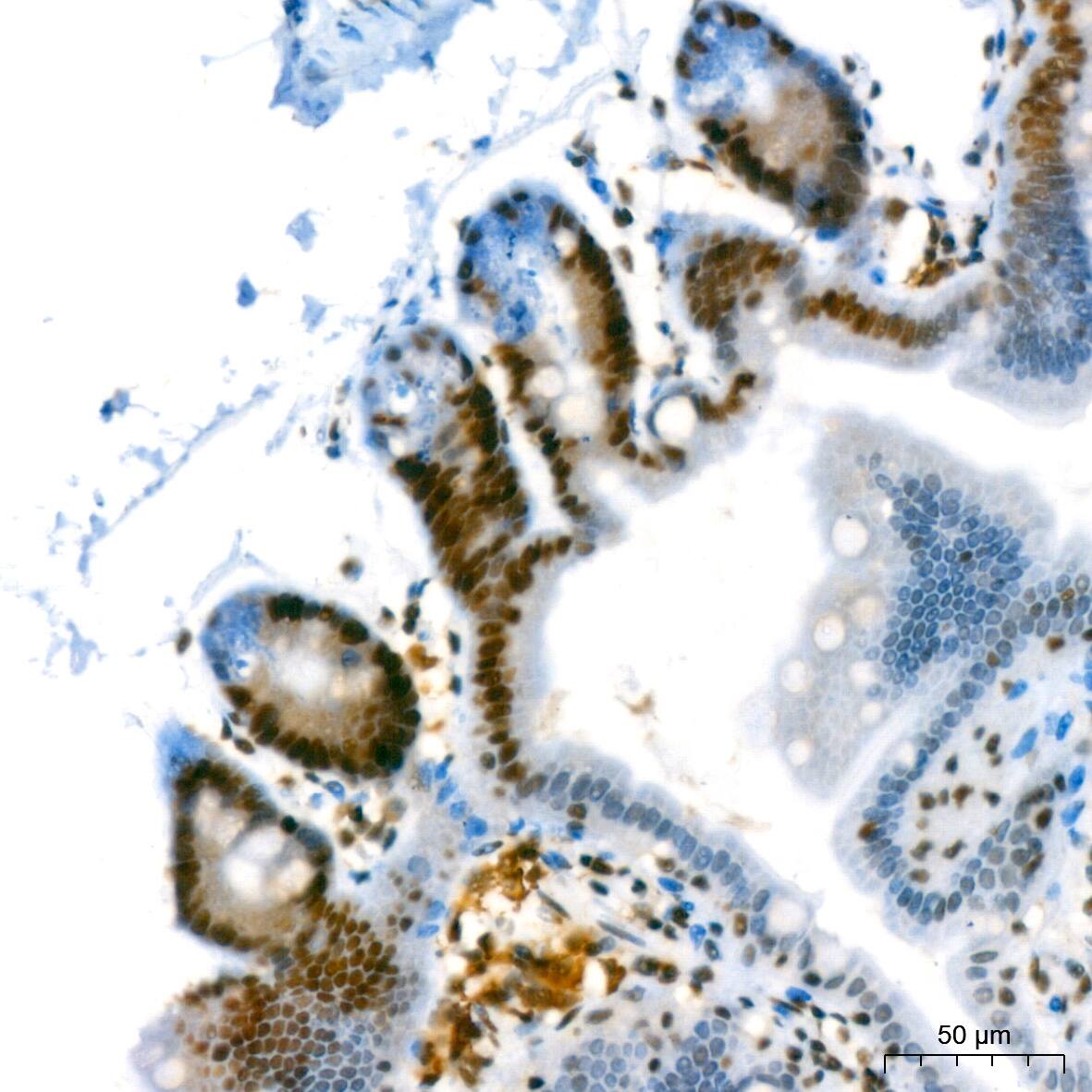 Immunohistochemistry: SUMO2/3 Antibody (6R8G7) [NBP3-16540] - Immunohistochemistry analysis of paraffin-embedded Mouse intestin using SUMO2/3 Rabbit mAb at dilution of 1:200 (40x lens). High pressure antigen retrieval performed with 0.01M Tris/EDTA Buffer (pH 9.0) prior to IHC staining.