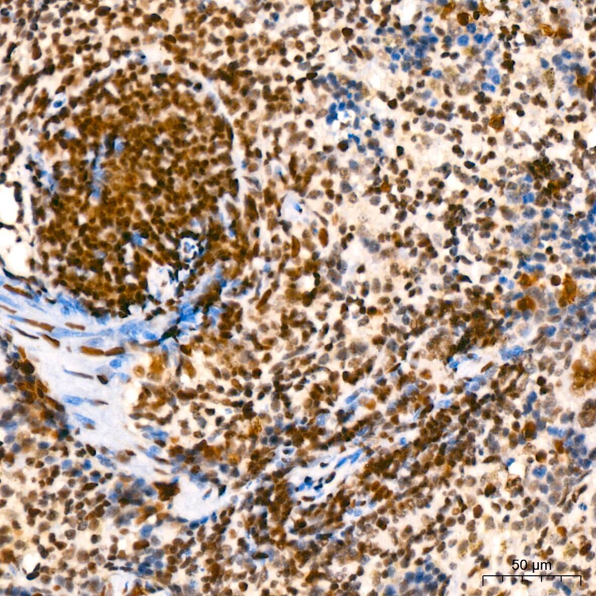 Immunohistochemistry: SUMO2/3 Antibody (6R8G7) [NBP3-16540] - Immunohistochemistry analysis of paraffin-embedded Mouse spleen using SUMO2/3 Rabbit mAb at dilution of 1:200 (40x lens). High pressure antigen retrieval performed with 0.01M Tris/EDTA Buffer (pH 9.0) prior to IHC staining.