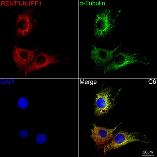 Immunocytochemistry/ Immunofluorescence: RENT1/UPF1/hUPF1 Antibody (5D5C4) [NBP3-16544] - Confocal imaging of C6 cells using RENT1/UPF1/hUPF1 Rabbit mAb  followed by a further incubation with Cy3 Goat Anti-Rabbit IgG (H+L).The cells were counterstained with alpha-Tubulin Mouse mAb followed by incubation with ABflo(R) 488-conjugated Goat Anti-Mouse IgG (H+L) Ab (Green).DAPI was used for nuclear staining (Blue). Objective: 100x.