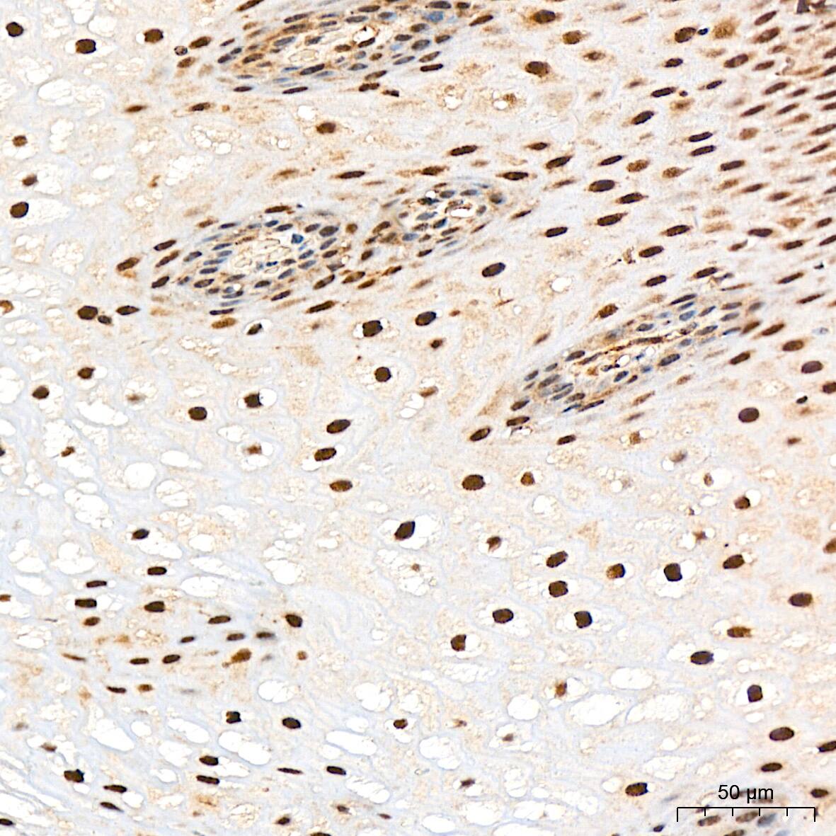 Immunohistochemistry: Proteasome 20S alpha 3 Antibody (7X8W9) [NBP3-16551] - Immunohistochemistry analysis of Proteasome 20S alpha 3 in paraffin-embedded human esophagus tissue using Proteasome 20S alpha 3 Rabbit mAb  at a dilution of 1:1000 (40x lens). High pressure antigen retrieval was performed with 0.01 M citrate buffer (pH 6.0) prior to IHC staining.