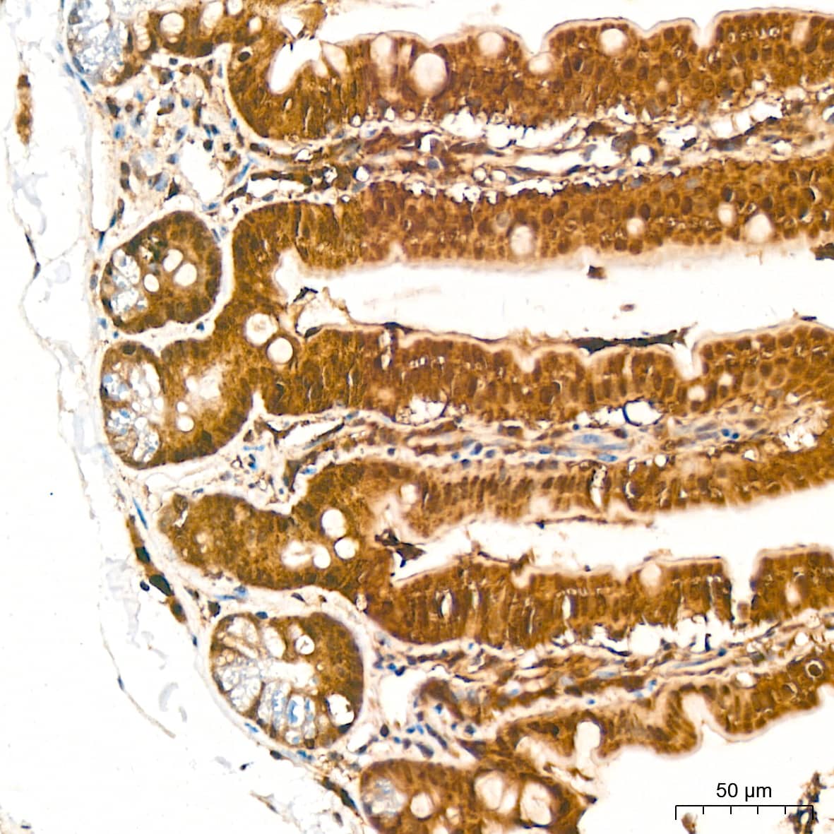 Immunohistochemistry: Proteasome 20S alpha 3 Antibody (7X8W9) [NBP3-16551] - Immunohistochemistry analysis of Proteasome 20S alpha 3 in paraffin-embedded mouse colon tissue using Proteasome 20S alpha 3 Rabbit mAb  at a dilution of 1:1000 (40x lens). High pressure antigen retrieval was performed with 0.01 M citrate buffer (pH 6.0) prior to IHC staining.