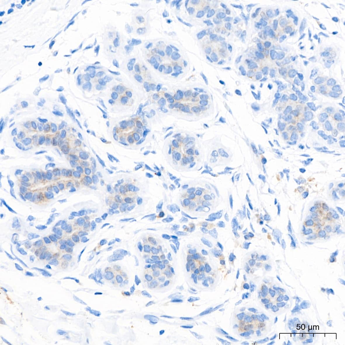 Immunohistochemistry: PAR2 Antibody (9X8E6) [NBP3-16555] - Immunohistochemistry analysis of paraffin-embedded Human breast tissue using PAR2 Rabbit mAb at a dilution of 1:500 (40x lens). High pressure antigen retrieval performed with 0.01M Tris-EDTA Buffer (pH 9.0) prior to IHC staining.