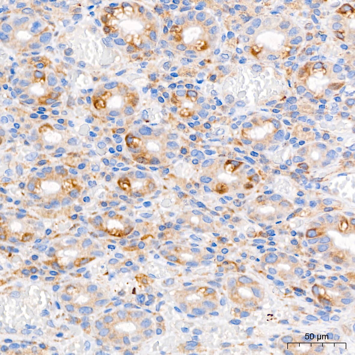 Immunohistochemistry: PAR2 Antibody (9X8E6) [PAR2] - Immunohistochemistry analysis of paraffin-embedded Human colon tissue using PAR2 Rabbit mAb  at a dilution of 1:500 (40x lens). High pressure antigen retrieval performed with 0.01M Tris-EDTA Buffer (pH 9.0) prior to IHC staining.