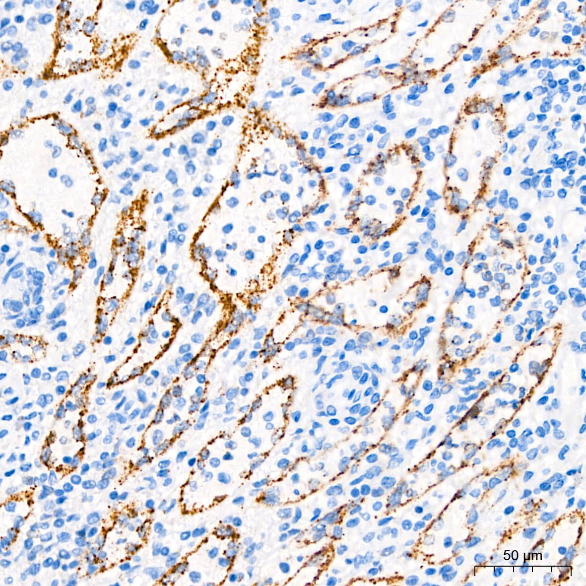 Immunohistochemistry: PAR2 Antibody (9X8E6) [PAR2] - Immunohistochemistry analysis of paraffin-embedded Human spleen tissue using PAR2 Rabbit mAb  at a dilution of 1:500 (40x lens). High pressure antigen retrieval performed with 0.01M Tris-EDTA Buffer (pH 9.0) prior to IHC staining.