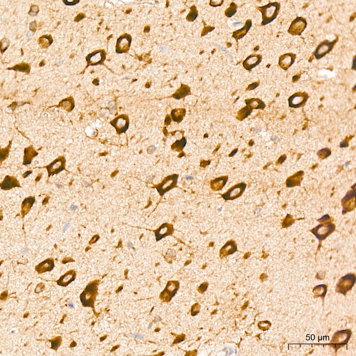 Immunohistochemistry: PA2G4/EBP1 Antibody (9J9U5) [NBP3-16561] - Immunohistochemistry analysis of PA2G4/EBP1 in paraffin-embedded rat brain tissue using PA2G4/EBP1 Rabbit mAb  at a dilution of 1:800 (40x lens). High pressure antigen retrieval was performed with 0.01 M citrate buffer (pH 6.0) prior to IHC staining.