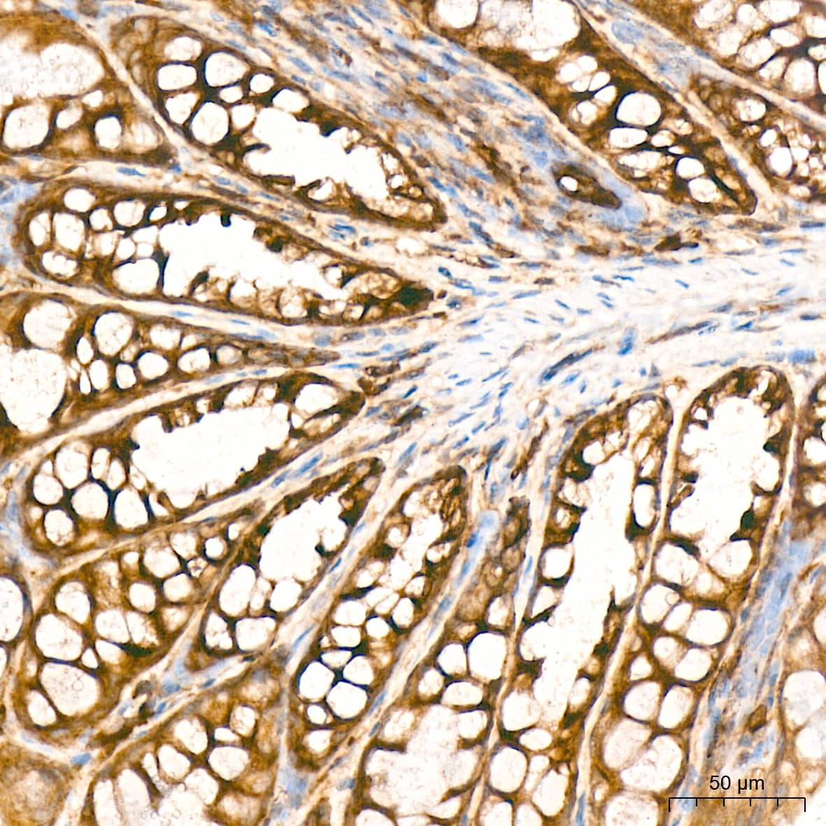 Immunohistochemistry: PA2G4/EBP1 Antibody (9J9U5) [NBP3-16561] - Immunohistochemistry analysis of PA2G4/EBP1 in paraffin-embedded mouse colon tissue using PA2G4/EBP1 Rabbit mAb  at a dilution of 1:800 (40x lens). High pressure antigen retrieval was performed with 0.01 M citrate buffer (pH 6.0) prior to IHC staining.