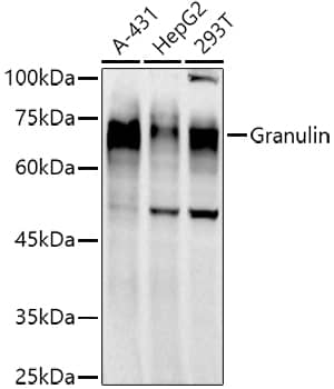 Western Blot: Granulin Antibody (8O5Q5) [NBP3-16566] - Western blot analysis of various lysates using Granulin Rabbit mAb at 1:1000 dilution.Secondary antibody: HRP-conjugated Goat anti-Rabbit IgG (H+L) at 1:10000 dilution.Lysates/proteins: 25ug per lane.Blocking buffer: 3% nonfat dry milk in TBST.Detection: ECL Basic Kit.Exposure time: 90s.