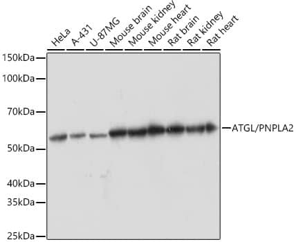 Western Blot: PEDFR/PNPLA2/ATGL Antibody (10Y4M10) [NBP3-16567] - Western blot analysis of various lysates using PEDFR/PNPLA2/ATGL Rabbit mAb at 1:1000 dilution.Secondary antibody: HRP-conjugated Goat anti-Rabbit IgG (H+L) at 1:10000 dilution.Lysates/proteins: 25ug per lane.Blocking buffer: 3% nonfat dry milk in TBST.Detection: ECL Basic Kit.Exposure time: 60s.