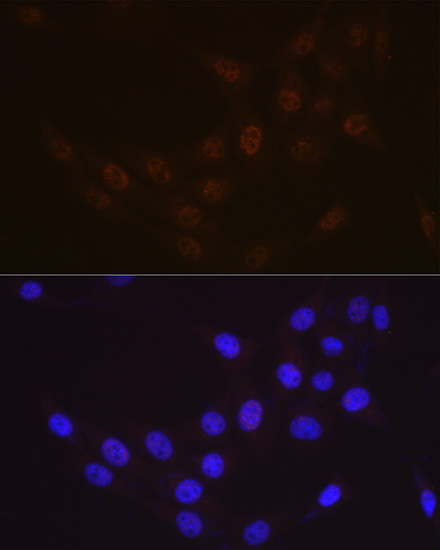 Immunocytochemistry/ Immunofluorescence: Rad23 Antibody (3B7T9) [NBP3-16573] - Immunofluorescence analysis of NIH-3T3 cells using Rad23 Rabbit mAb at dilution of 1:100 (40x lens). Blue: DAPI for nuclear staining.