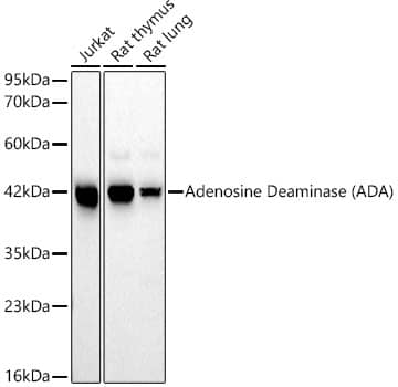 Western Blot: Adenosine Deaminase/ADA Antibody (5R10B4) [NBP3-16575] - Western blot analysis of various lysates, using Adenosine Deaminase/ADA Rabbit mAb  at 1:1000 dilution.Secondary antibody: HRP Goat Anti-Rabbit IgG (H+L)  at 1:10000 dilution.Lysates/proteins: 25ug per lane.Blocking buffer: 3% nonfat dry milk in TBST.Detection: ECL Basic Kit .Exposure time: 60s.