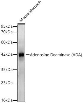 Western Blot: Adenosine Deaminase/ADA Antibody (5R10B4) [NBP3-16575] - Western blot analysis of Mouse stomach, using Adenosine Deaminase/ADA Rabbit mAb  at 1:1000 dilution.Secondary antibody: HRP Goat Anti-Rabbit IgG (H+L)  at 1:10000 dilution.Lysates/proteins: 25ug per lane.Blocking buffer: 3% nonfat dry milk in TBST.Detection: ECL Enhanced Kit .Exposure time: 45s.