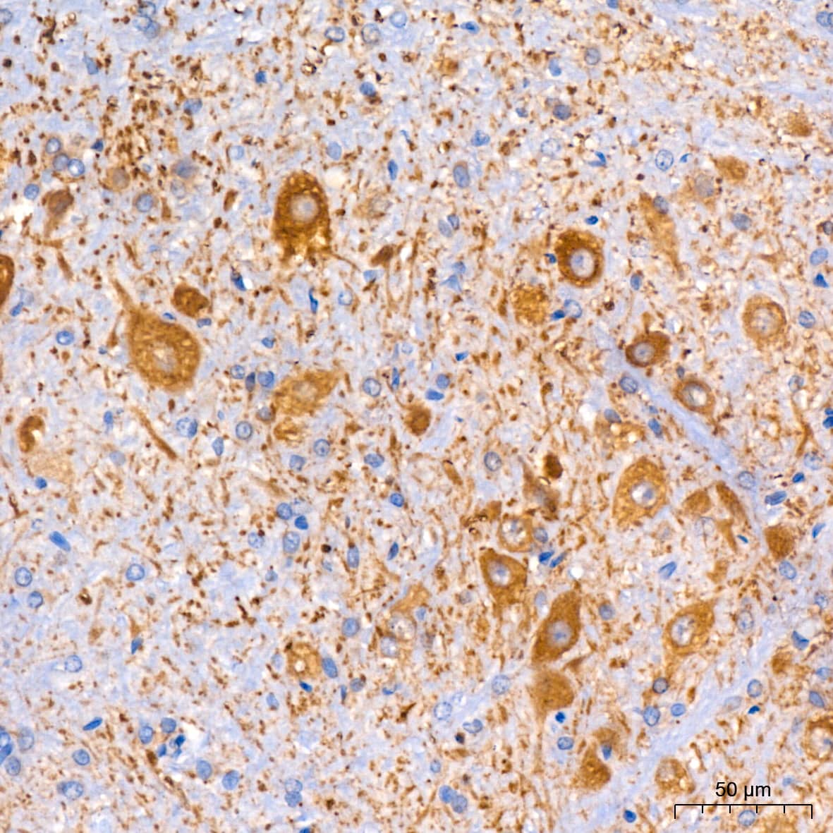 Immunohistochemistry: Muscarinic Acetylcholine Receptor M2/CHRM2 Antibody (3T5W8) [NBP3-16576] - Immunohistochemistry analysis of paraffin-embedded Rat brain tissue using Muscarinic AChR M2 Rabbit mAb at a dilution of 1:200 (40x lens). High pressure antigen retrieval performed with 0.01M Citrate Bufferr (pH 6.0) prior to IHC staining.