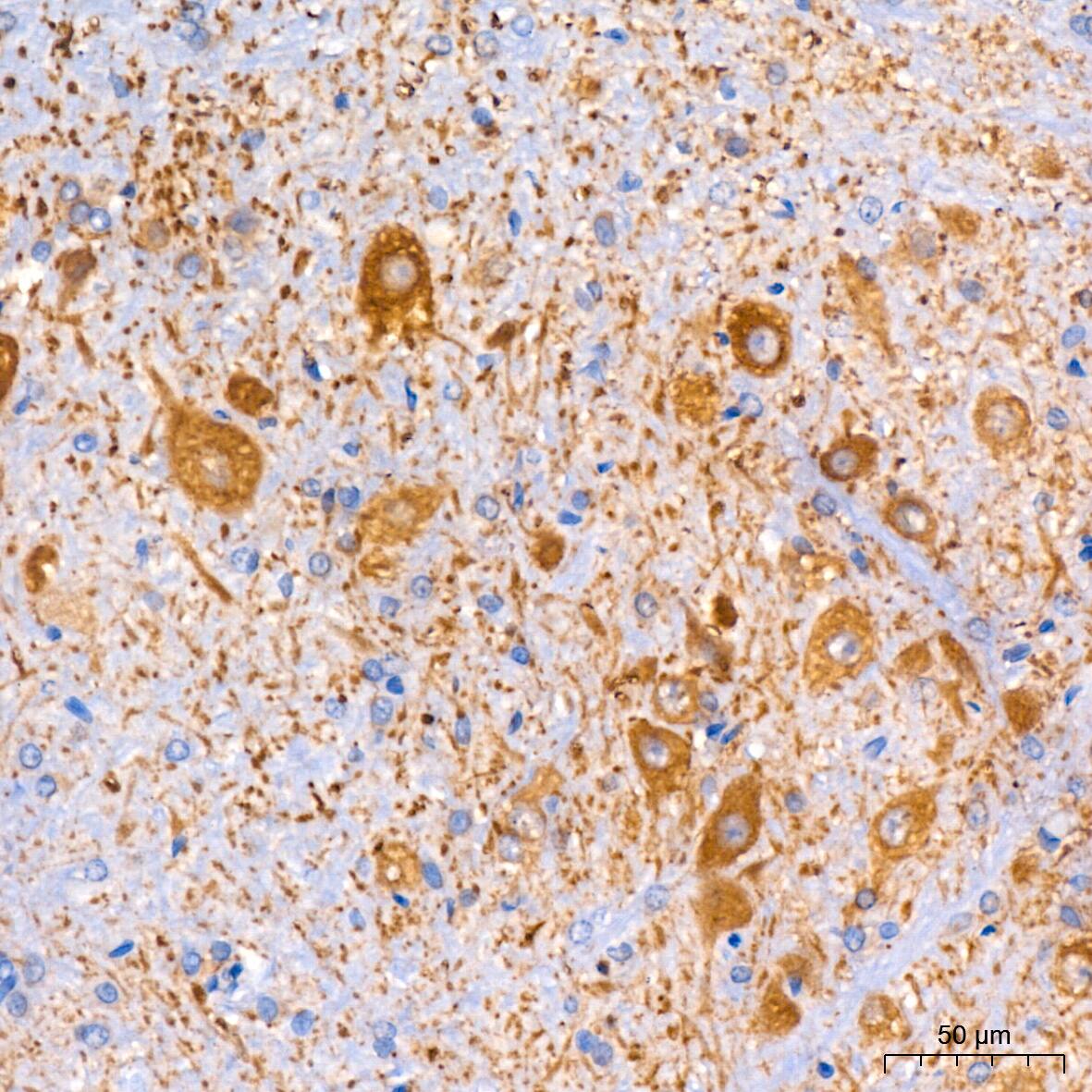 Immunohistochemistry: Muscarinic Acetylcholine Receptor M2/CHRM2 Antibody (3T5W8) [Muscarinic Acetylcholine Receptor M2/CHRM2] - Immunohistochemistry analysis of paraffin-embedded Rat brain tissue using Muscarinic Acetylcholine Receptor M2/CHRM2 Rabbit mAb  at a dilution of 1:200 (40x lens). High pressure antigen retrieval performed with 0.01M Citrate Bufferr (pH 6.0) prior to IHC staining.