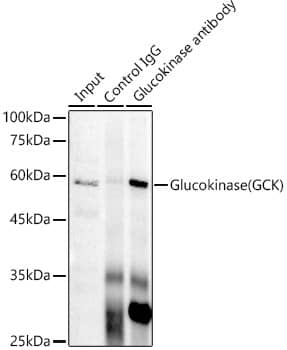 Immunoprecipitation: Glucokinase/GCK Antibody (4K9D5) [NBP3-16579] - Immunoprecipitation analysis of 300 ug extracts of HeLa cells using 3 ug Glucokinase/GCK antibody . Western blot was performed from the immunoprecipitate using Glucokinase/GCK antibody at a dilution of 1:1000.