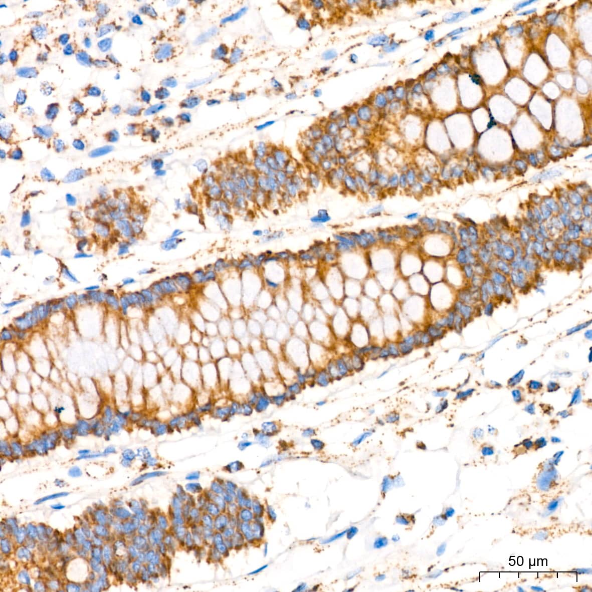 Immunohistochemistry: Glutamate Dehydrogenase Antibody (7L7N2) [NBP3-16582] - Immunohistochemistry analysis of paraffin-embedded Human colon tissue using Glutamate Dehydrogenase Rabbit mAb at a dilution of 1:200 (40x lens). High pressure antigen retrieval performed with 0.01M Tris-EDTA Buffer (pH 9.0) prior to IHC staining.