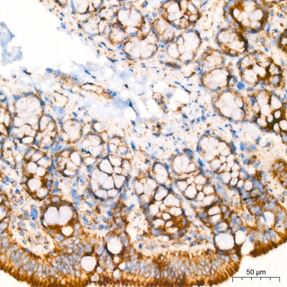 Immunohistochemistry: Glutamate Dehydrogenase Antibody (7L7N2) [NBP3-16582] - Immunohistochemistry analysis of paraffin-embedded Rat colon tissue using Glutamate Dehydrogenase Rabbit mAb at a dilution of 1:200 (40x lens). High pressure antigen retrieval performed with 0.01M Tris-EDTA Buffer (pH 9.0) prior to IHC staining.