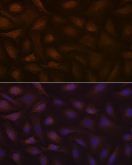 Immunocytochemistry/ Immunofluorescence: KIFAP3 Antibody (1S7J7) [NBP3-16592] - Immunofluorescence analysis of U-2 OS cells using KIFAP3 Rabbit mAb  at dilution of 1:100 (40x lens). Blue: DAPI for nuclear staining.