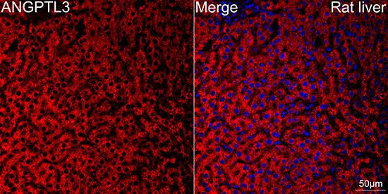 Immunocytochemistry/ Immunofluorescence: Angiopoietin-like Protein 3/ANGPTL3 Antibody (4W9A7) [NBP3-16596] - Confocal imaging of paraffin-embedded Rat liver using Angiopoietin-like Protein 3/ANGPTL3 Rabbit mAb followed by a further incubation with Cy3 Goat Anti-Rabbit IgG (H+L) . DAPI was used for nuclear staining (Blue). Objective: 40x. Perform high pressure antigen retrieval with 0.01 M citrate buffer (pH 6.0) prior to IF staining.