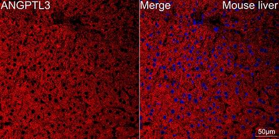 Immunocytochemistry/ Immunofluorescence: Angiopoietin-like Protein 3/ANGPTL3 Antibody (4W9A7) [Angiopoietin-like Protein 3/ANGPTL3] - Confocal imaging of paraffin-embedded Mouse liver using Angiopoietin-like Protein 3/ANGPTL3 Rabbit mAb  followed by a further incubation with Cy3 Goat Anti-Rabbit IgG (H+L)  . DAPI was used for nuclear staining (Blue). Objective: 40x. Perform high pressure antigen retrieval with 0.01 M citrate buffer (pH 6.0) prior to IF staining.