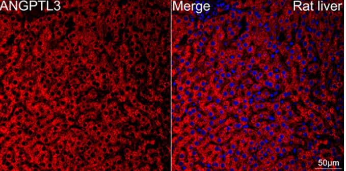 Immunohistochemistry-Paraffin: Angiopoietin-like Protein 3/ANGPTL3 Antibody (4W9A7) [NBP3-16596] - Confocal imaging of paraffin-embedded Rat liver using ANGPTL3 Rabbit mAb (dilution 1:200) followed by a further incubation with Cy3 Goat Anti-Rabbit IgG (H+L) (dilution 1:500) (Red). DAPI was used for nuclear staining (Blue). Objective: 40x. Perform high pressure antigen retrieval with 0.01 M citrate buffer (pH 6.0) prior to IF staining.