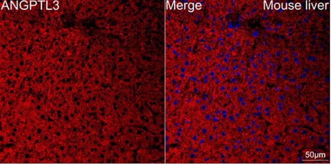 Immunohistochemistry-Paraffin: Angiopoietin-like Protein 3/ANGPTL3 Antibody (4W9A7) [NBP3-16596] - Confocal imaging of paraffin-embedded Mouse liver using ANGPTL3 Rabbit mAb (dilution 1:200) followed by a further incubation with Cy3 Goat Anti-Rabbit IgG (H+L) (dilution 1:500) (Red). DAPI was used for nuclear staining (Blue). Objective: 40x. Perform high pressure antigen retrieval with 0.01 M citrate buffer (pH 6.0) prior to IF staining.