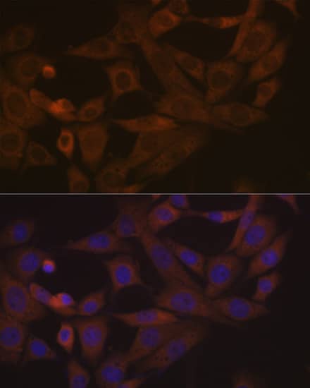 Immunocytochemistry/ Immunofluorescence: Desmoglein-3 Antibody (1T1D5) [NBP3-16597] - Immunofluorescence analysis of NIH-3T3 cells using Desmoglein-3 Rabbit mAb  at dilution of 1:100 (40x lens). Blue: DAPI for nuclear staining.