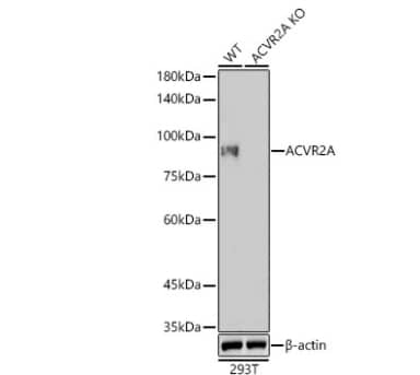 Western Blot: Activin RIIA Antibody (1K1J10) [NBP3-16598] -  Analysis of lysates from wild type (WT) and ACVR2A knockout (KO) 293T cells, using [KO Validated] ACVR2A Rabbit mAb at 1:1000 dilution.Secondary antibody: HRP-conjugated Goat anti-Rabbit IgG (H+L) at 1:10000 dilution.Lysates/proteins: 25ug per lane.Blocking buffer: 3% nonfat dry milk in TBST.Detection: ECL Enhanced Kit. Exposure time: 180s.