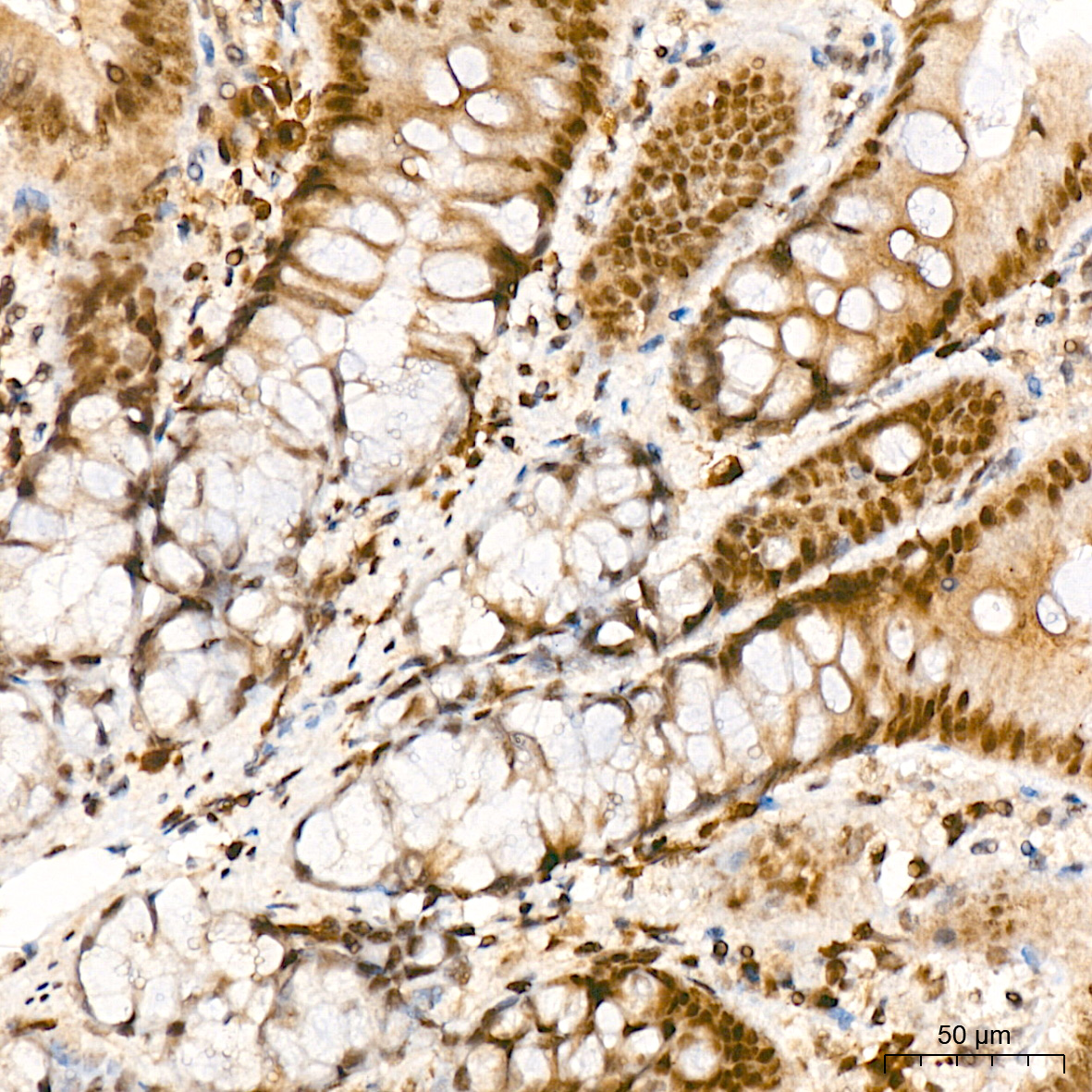 Immunohistochemistry: JunD Antibody (2D5A1) [JunD] - Immunohistochemistry analysis of JunD in paraffin-embedded rat colon tissue using JunD Rabbit mAb  at a dilution of 1:200 (40x lens). High pressure antigen retrieval was performed with 0.01 M Tris-EDTA buffer (pH 9.0) prior to IHC staining.