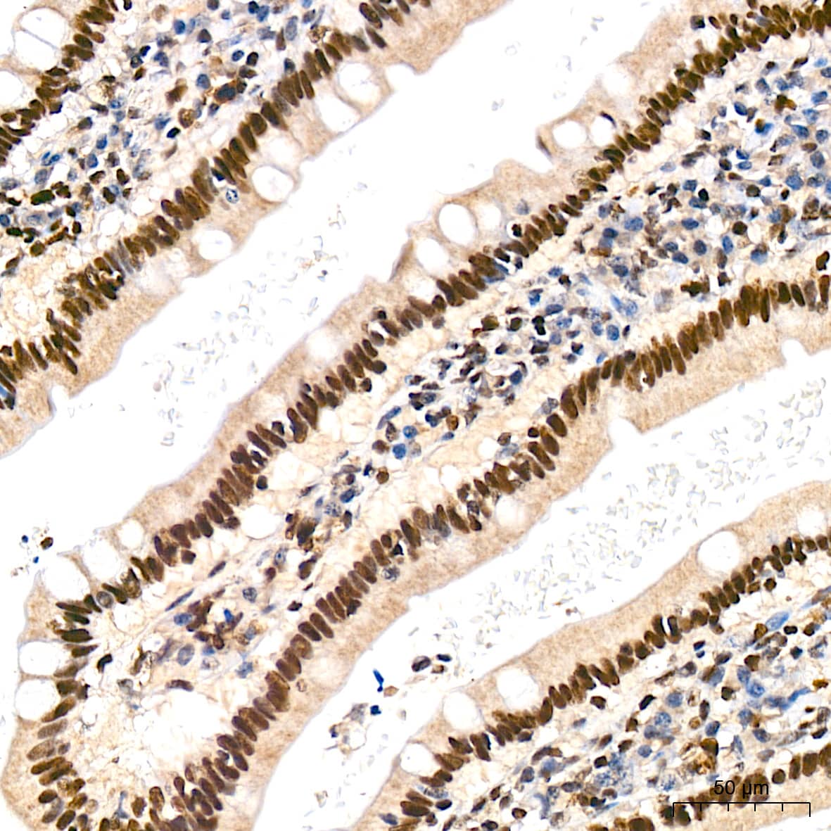 Immunohistochemistry: JunD Antibody (2D5A1) [NBP3-16602] - Immunohistochemistry analysis of JunD in paraffin-embedded human small intestine tissue using JunD Rabbit mAb  at a dilution of 1:200 (40x lens). High pressure antigen retrieval was performed with 0.01 M Tris-EDTA buffer (pH 9.0) prior to IHC staining.