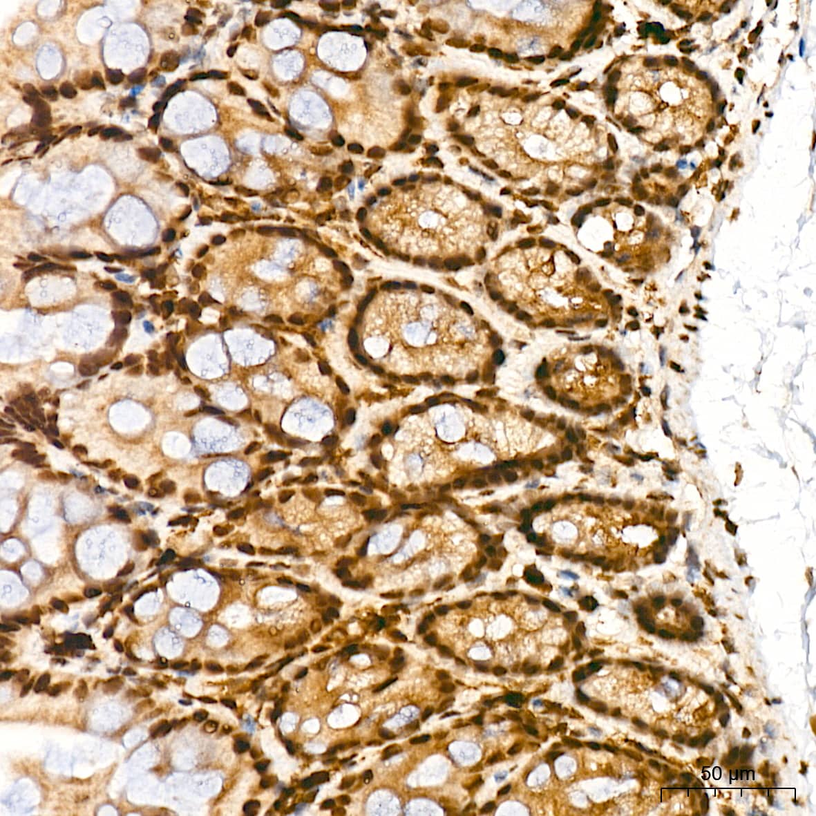 Immunohistochemistry: JunD Antibody (2D5A1) [NBP3-16602] - Immunohistochemistry analysis of JunD in paraffin-embedded mouse colon tissue using JunD Rabbit mAb  at a dilution of 1:200 (40x lens). High pressure antigen retrieval was performed with 0.01 M Tris-EDTA buffer (pH 9.0) prior to IHC staining.