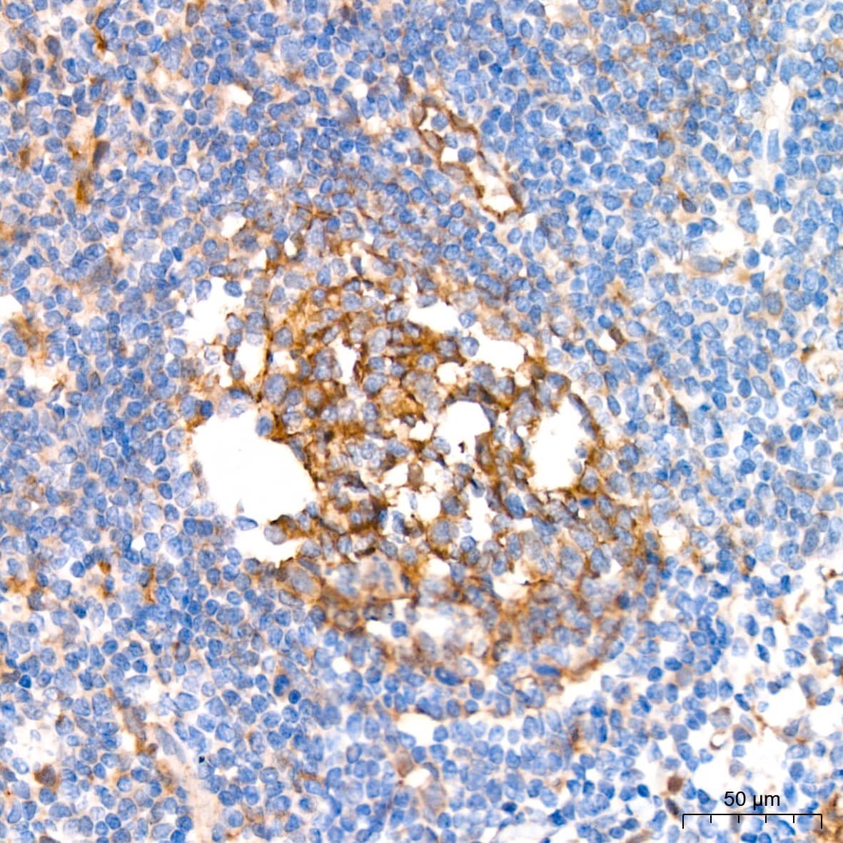Immunohistochemistry: Syntenin 1 Antibody (3J5O6) [Syntenin 1] - Immunohistochemistry analysis of paraffin-embedded Human tonsil tissue using Syntenin 1 Rabbit mAb  at a dilution of 1:200 (40x lens). High pressure antigen retrieval performed with 0.01M Tris-EDTA Buffer (pH 9.0) prior to IHC staining.