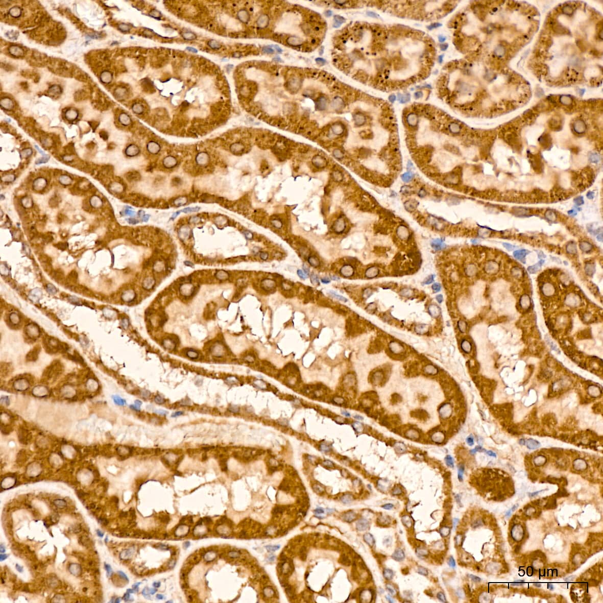 Immunohistochemistry: HSP10/EPF Antibody (0H0X6) [NBP3-16604] - Immunohistochemistry analysis of paraffin-embedded Rat kidney tissue using HSP10/EPF Rabbit mAb at a dilution of 1:400 (40x lens). High pressure antigen retrieval was performed with 0.01 M citrate buffer (pH 6.0) prior to IHC staining.