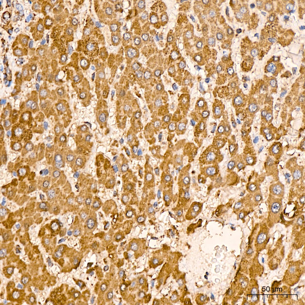 Immunohistochemistry: HSP10/EPF Antibody (0H0X6) [NBP3-16604] - Immunohistochemistry analysis of paraffin-embedded Human liver tissue using HSP10/EPF Rabbit mAb at a dilution of 1:400 (40x lens). High pressure antigen retrieval was performed with 0.01 M citrate buffer (pH 6.0) prior to IHC staining.