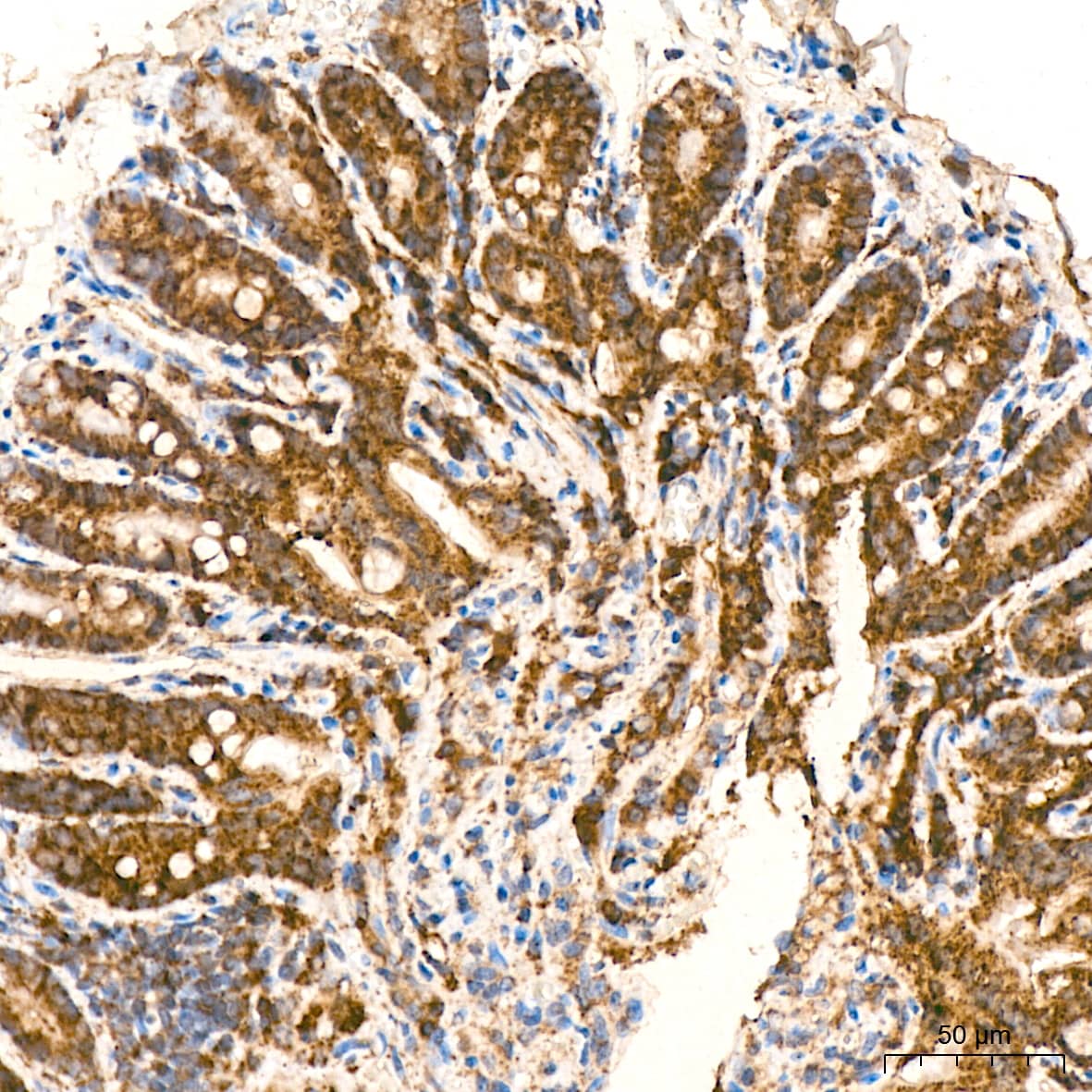 Immunohistochemistry: HSP10/EPF Antibody (0H0X6) [NBP3-16604] - Immunohistochemistry analysis of paraffin-embedded Mouse colon tissue using HSP10/EPF Rabbit mAb at a dilution of 1:400 (40x lens). High pressure antigen retrieval was performed with 0.01 M citrate buffer (pH 6.0) prior to IHC staining.