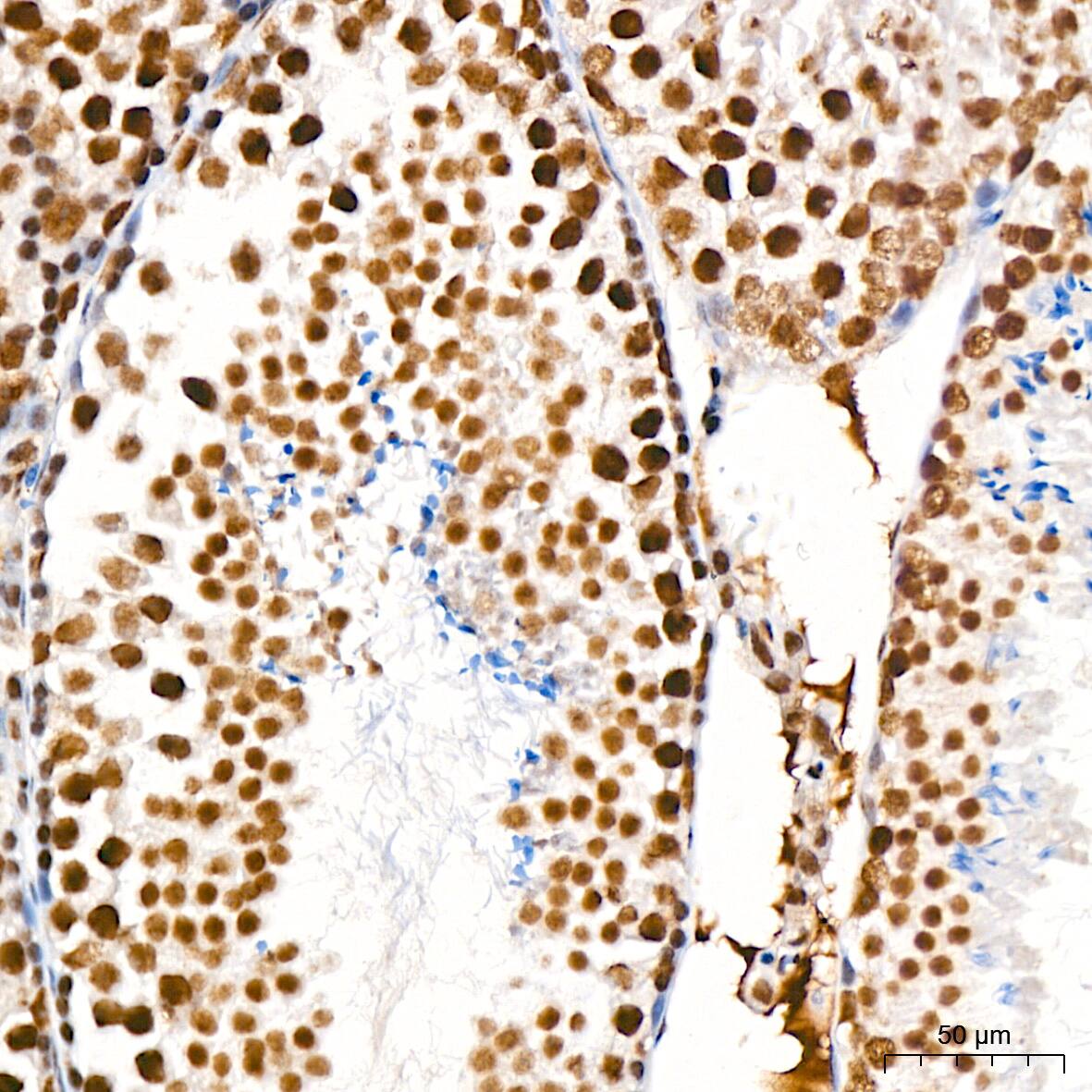 Immunohistochemistry: DDX17 Antibody (2U1P0) [NBP3-16607] - Immunohistochemistry analysis of DDX17 in paraffin-embedded mouse testis tissue using DDX17 Rabbit mAb  at a dilution of 1:200 (40x lens).High pressure antigen retrieval was performed with 0.01 M Tris-EDTA buffer (pH 9.0) prior to IHC staining.