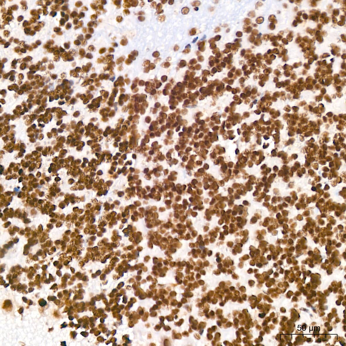 Immunohistochemistry: DDX17 Antibody (2U1P0) [NBP3-16607] - Immunohistochemistry analysis of DDX17 in paraffin-embedded rat brain tissue using DDX17 Rabbit mAb  at a dilution of 1:200 (40x lens).High pressure antigen retrieval was performed with 0.01 M Tris-EDTA buffer (pH 9.0) prior to IHC staining.