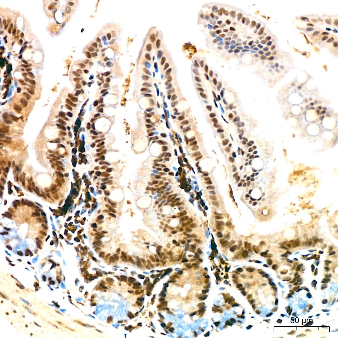 Immunohistochemistry: DDX17 Antibody (2U1P0) [NBP3-16607] - Immunohistochemistry analysis of DDX17 in paraffin-embedded mouse intestin tissue using DDX17 Rabbit mAb  at a dilution of 1:200 (40x lens).High pressure antigen retrieval was performed with 0.01 M Tris-EDTA buffer (pH 9.0) prior to IHC staining.